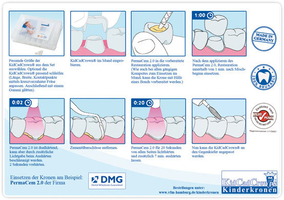 Das Einsetzen der KidCadCrowns® 2.0